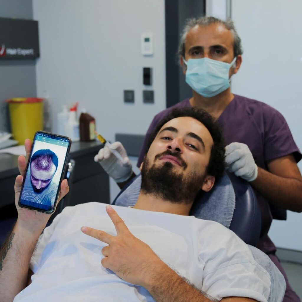 Hair transplant before and after