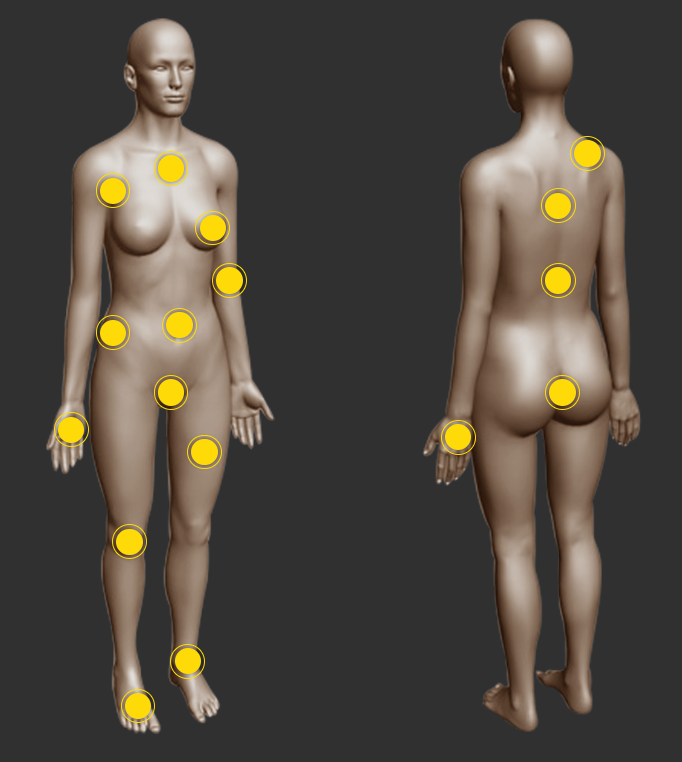 laser body treatment