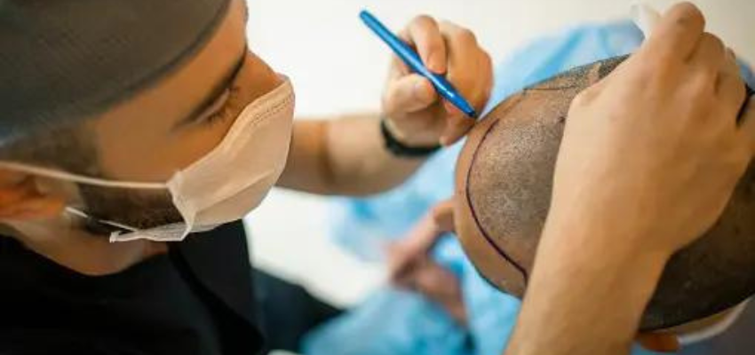 Turkey Surgery Guide